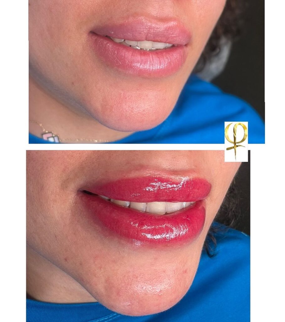 lip2